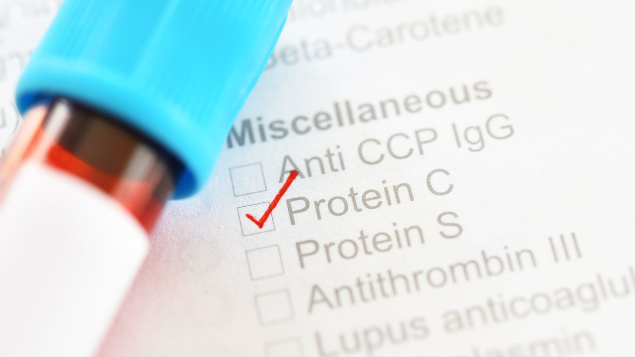 proteina c reactiva alta proteina c reactiva alta